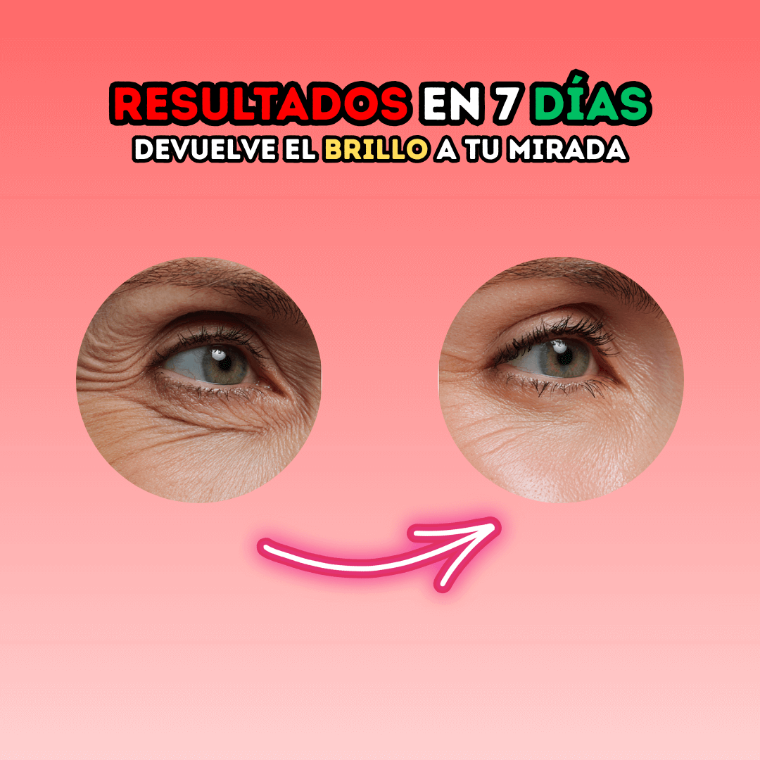 DERMAVIVE | Adiós a las ojeras en 7 Días