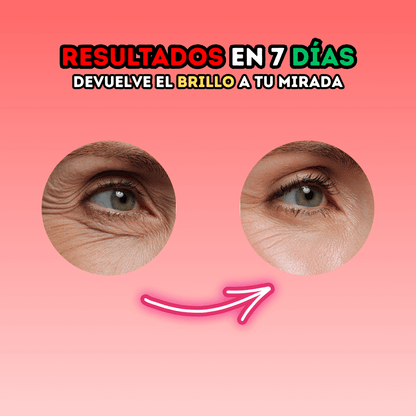 DERMAVIVE | Adiós a las ojeras en 7 Días